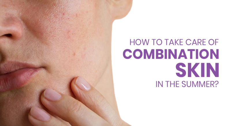 How to take care of combination skin in the summer?